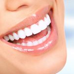 تفاوت لمینت و کامپوزیت دندان