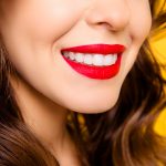 لمینت دندان بدون تراش
